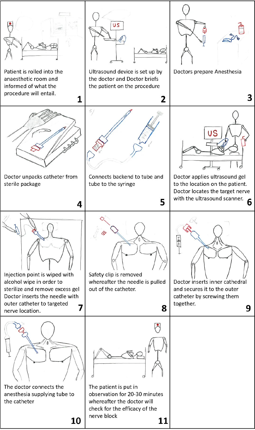 Portrait crop of the source Pajunk CPNB storyboard containing eleven illustrated procedure steps.