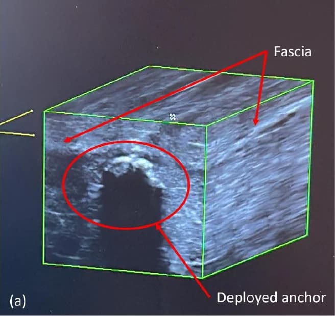Project photograph of ultrasound observation during the ex-vivo beef-tissue session.